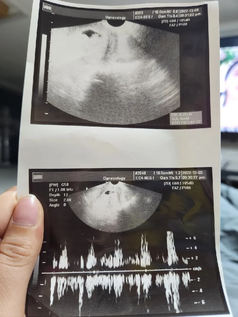 이 저녁에 병원..