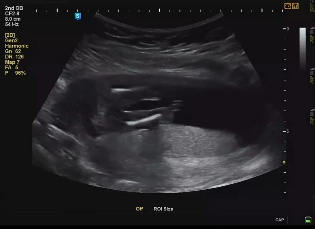 오늘 기형아 검사 하고 왔습니다 ㅎ0ㅎ