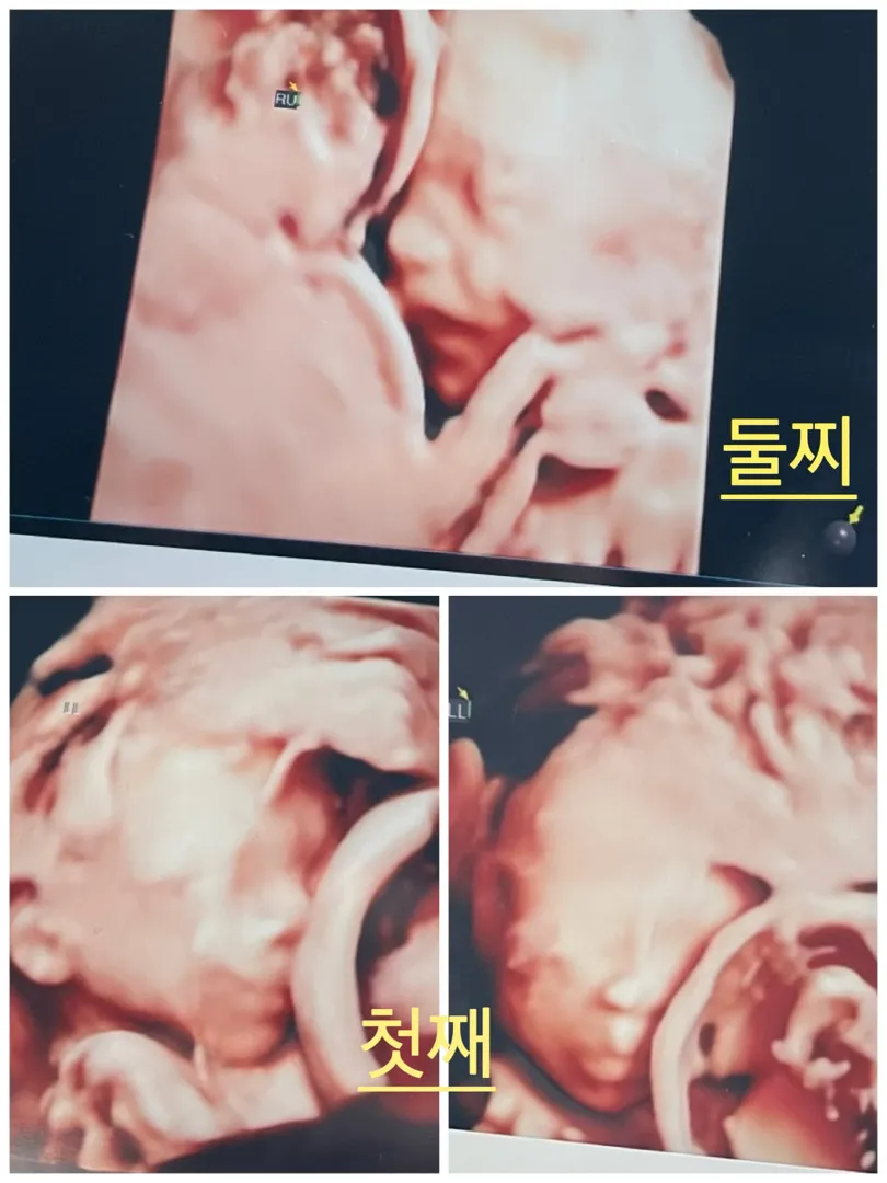 쌍둥이맘 20주 정밀초음파 보고 왔어요!!