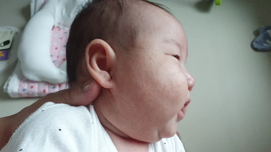 태열일까요 ㅜㅜ..??