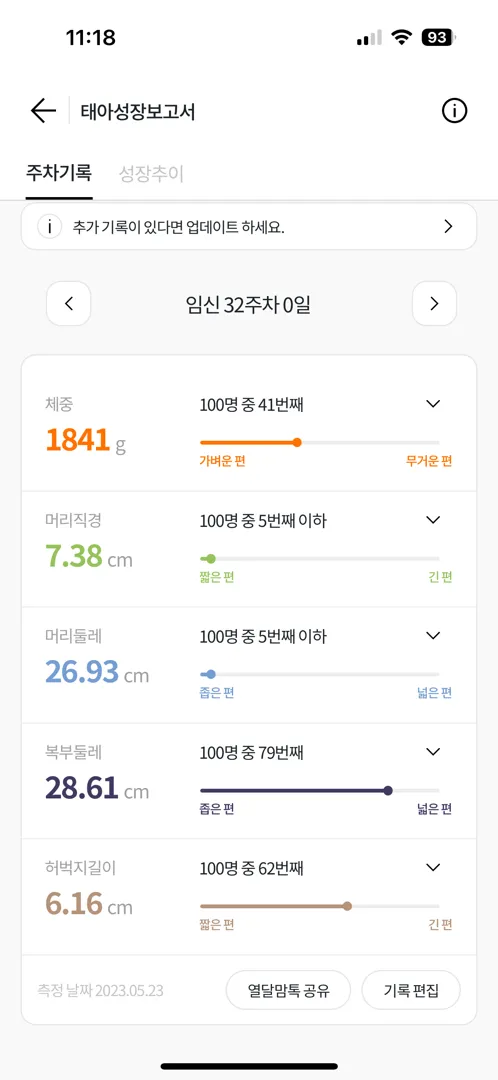 태아 머리크기