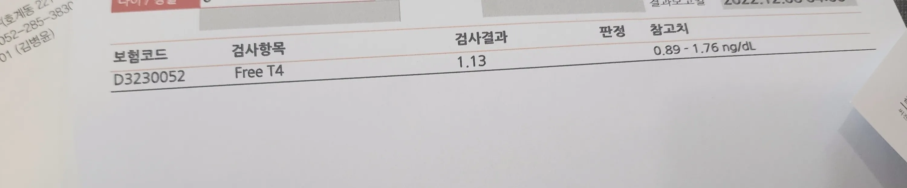 갑상선 항진증