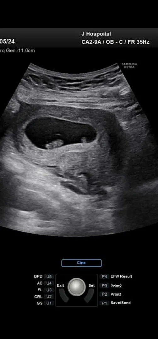 7주3일 깽이 보고왔어요