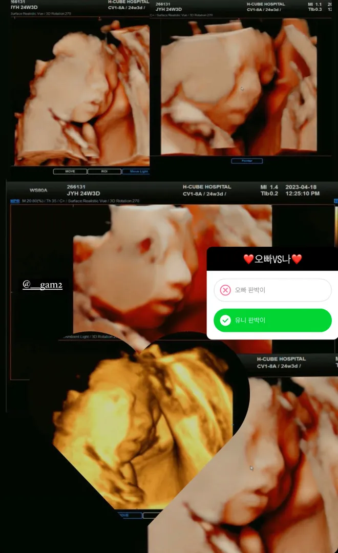 25주 입체초음파 ~ 입니다