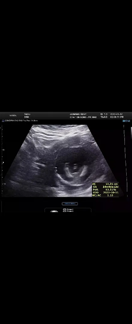 community post image
