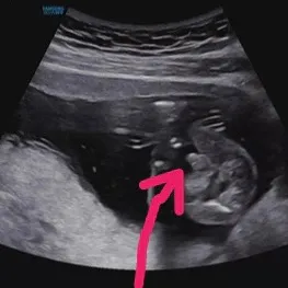 아들맘 확정받았어요😂🤣