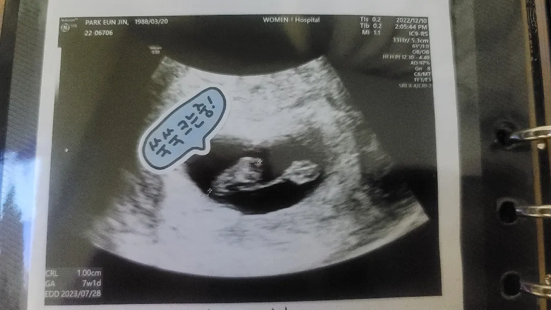 6주6일차 반짝이 보고왔어요!