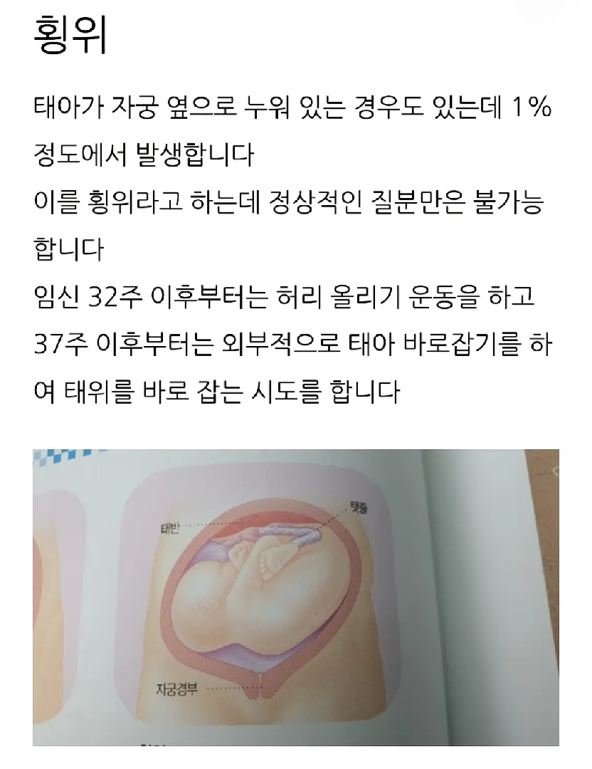 30주 아기위치