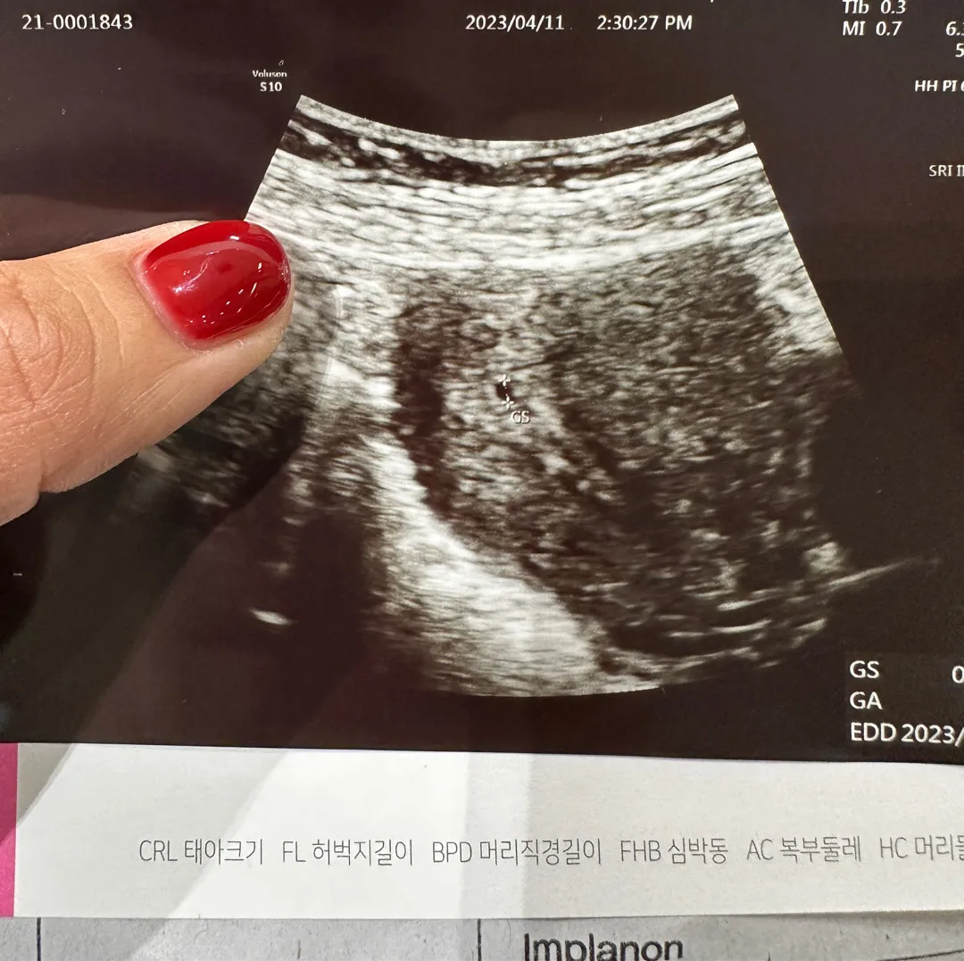 테스트기 연한줄 확인후 8일뒤 초음파 !
