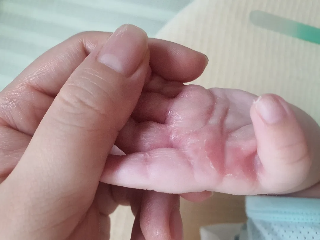 손빠는 아기 어떻게 관리하시나요?
