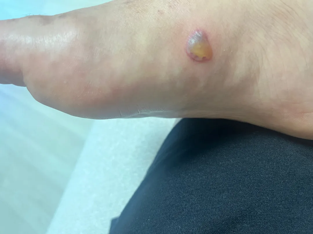 안녕하세요 ㅠㅠ
