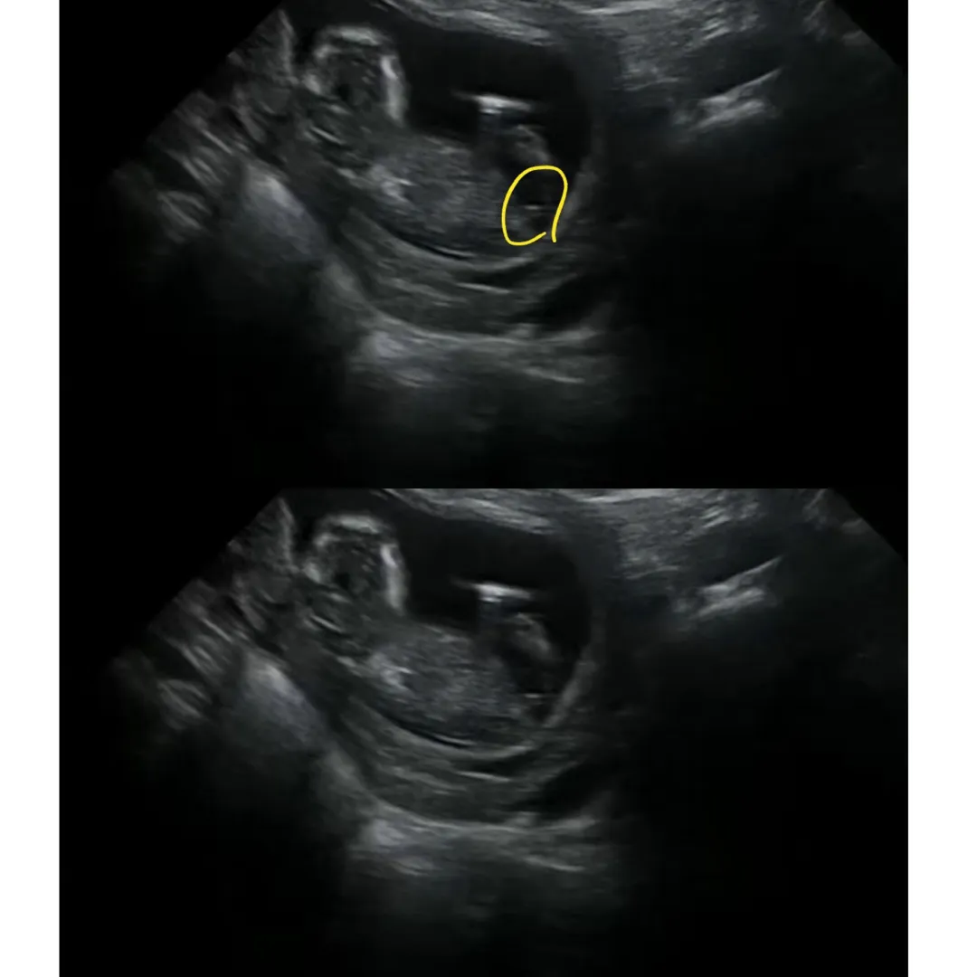 13주차입니다 각도법부탁드려요ㅠㅠ
