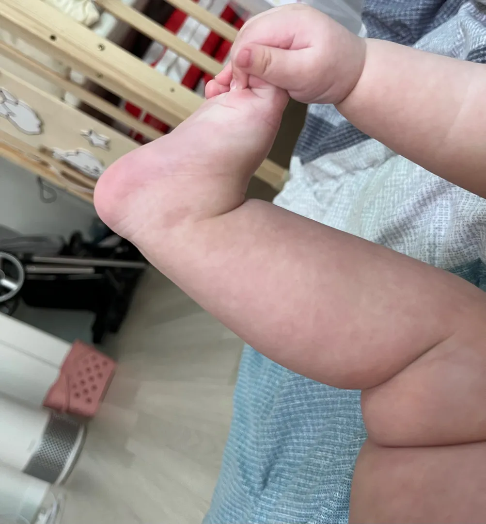 발은잡는데 뒤집기는아직,,,,ㅠ