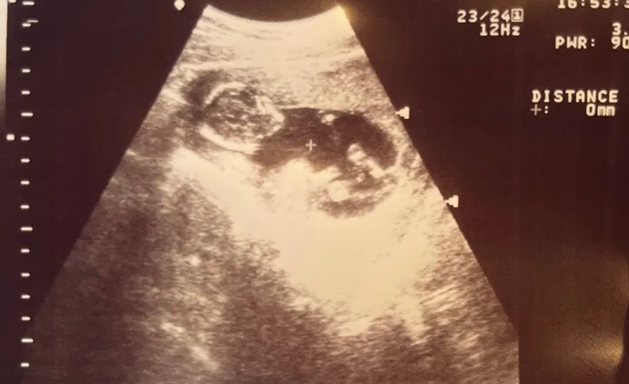 14주 성별