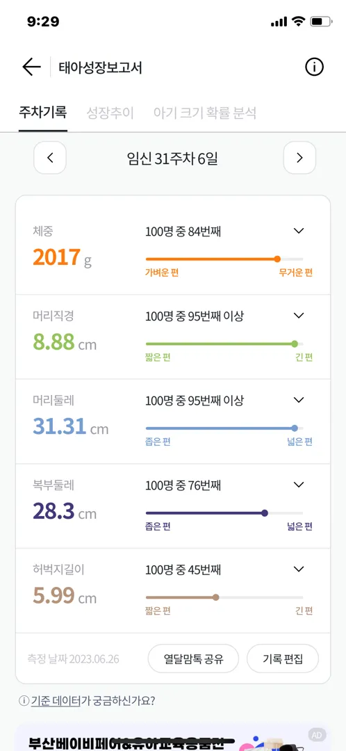 38w1d제왕 괜찮을가요?