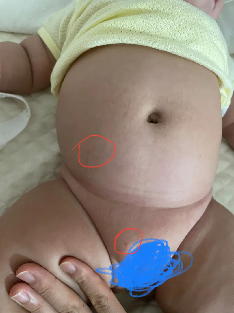 빨간 반점