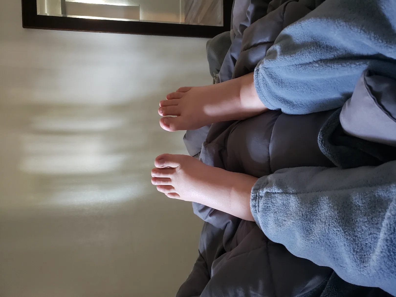 발 너무 심하게 붓는데 괜찮을까요...?