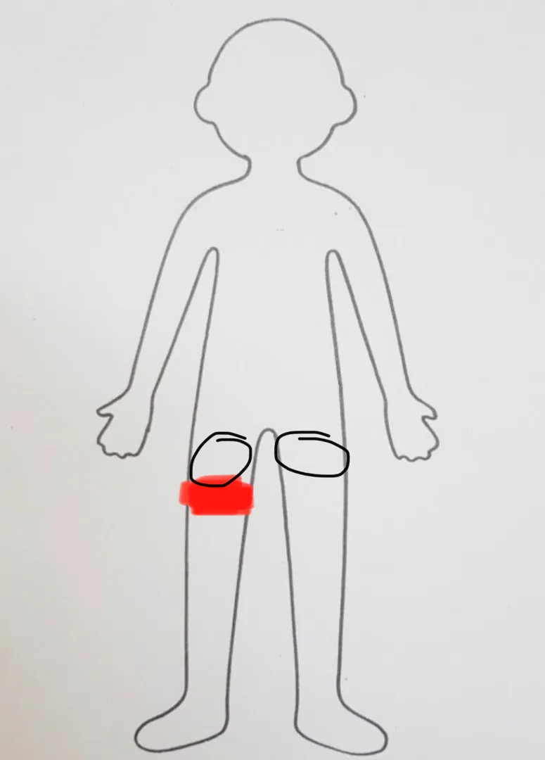 좌골신경통? 골반통증? 뭔지 모르겠어요ㅠㅠ