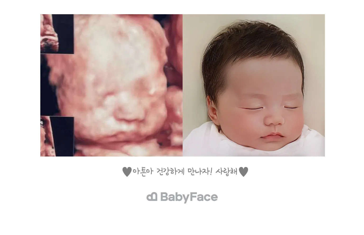 베이비페이스 태교❤️