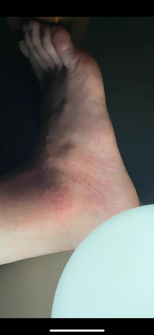 새벽만 되면 배고파요.....피부좀 봐주세요