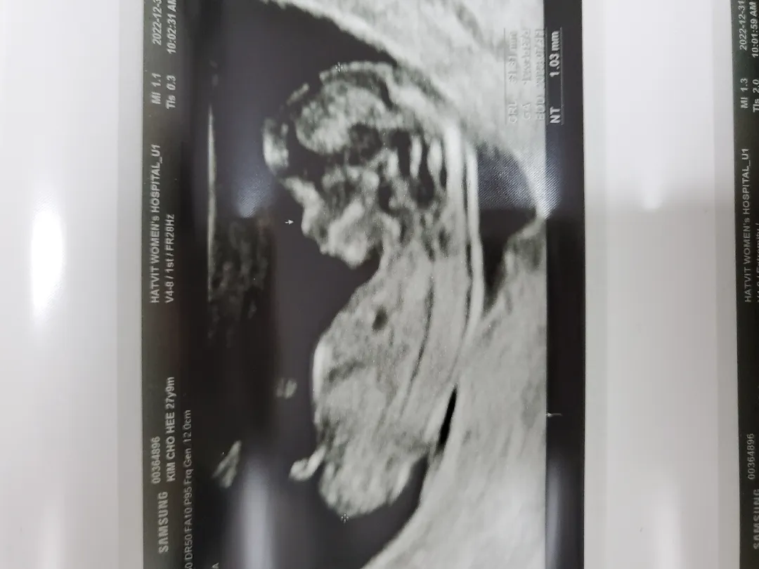 12주 각도법 ㅠㅠ 너무 궁금해요