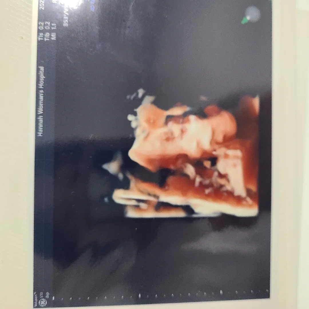 25주차 초음파 , 임당재검