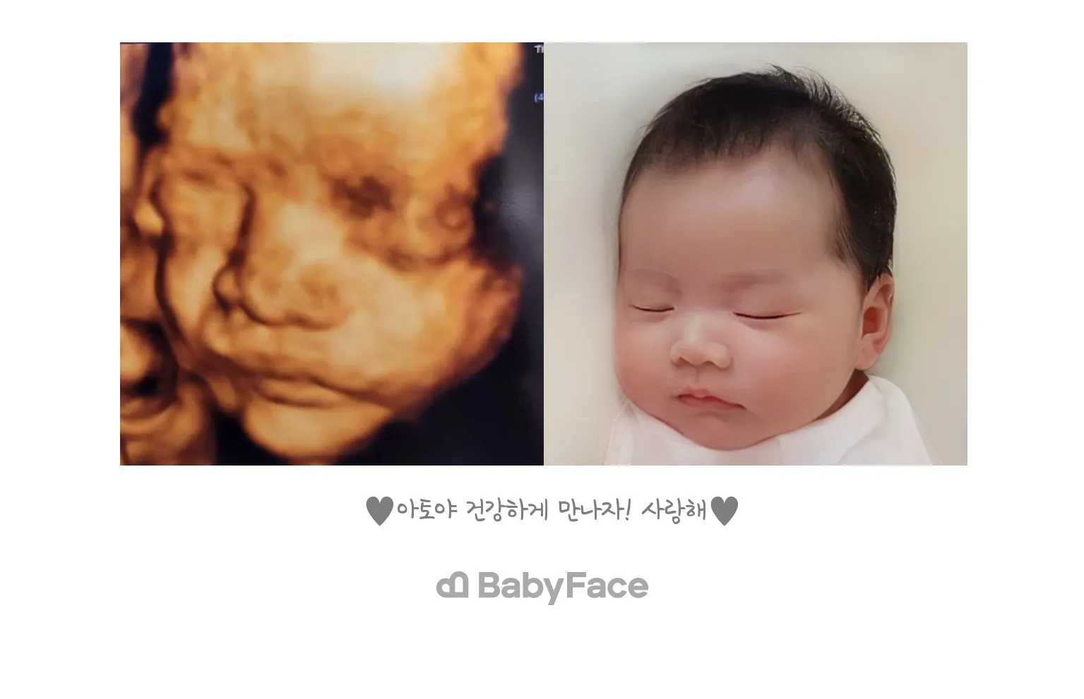 입체초음파 베이비페이스♡