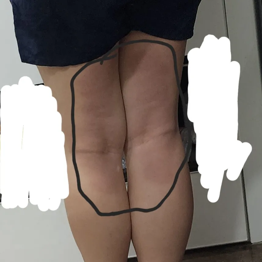 피부가 이상한데 혹시 아시는분 계실까요?