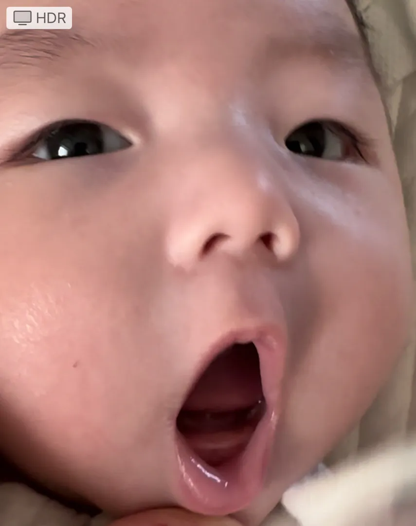 이러다가 이가 뿅 하고 나는건가요?!?