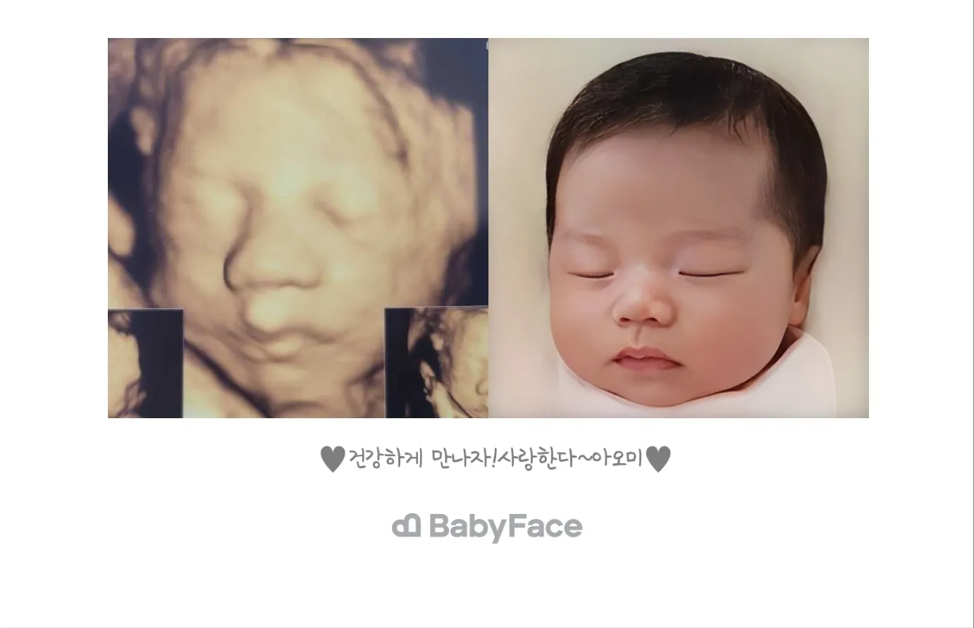 베이비페이스에요^^ 
