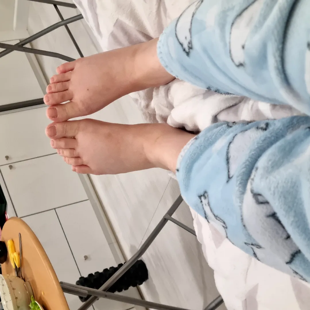 발이 붓고 있네요