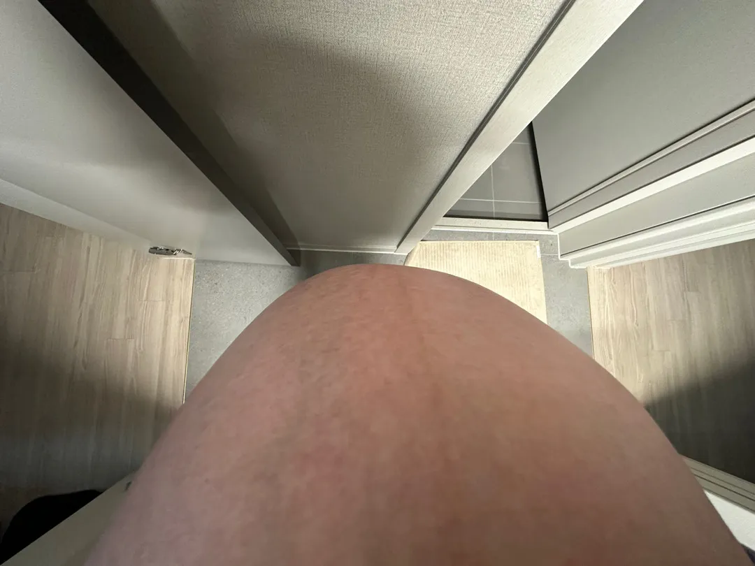 배뭉침인가요?