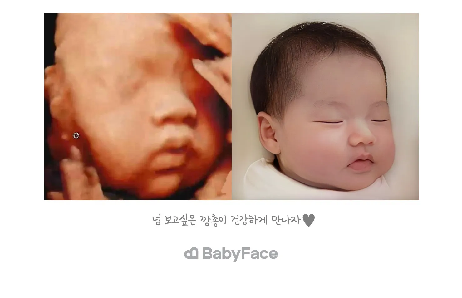 베이비페이스 후기 !