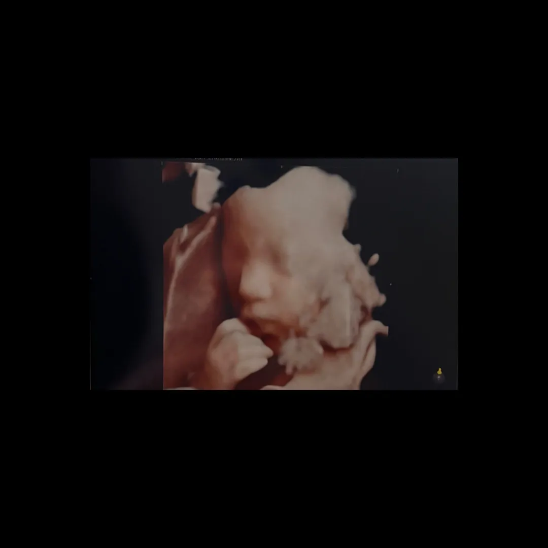 저희 애기 오때용 ?