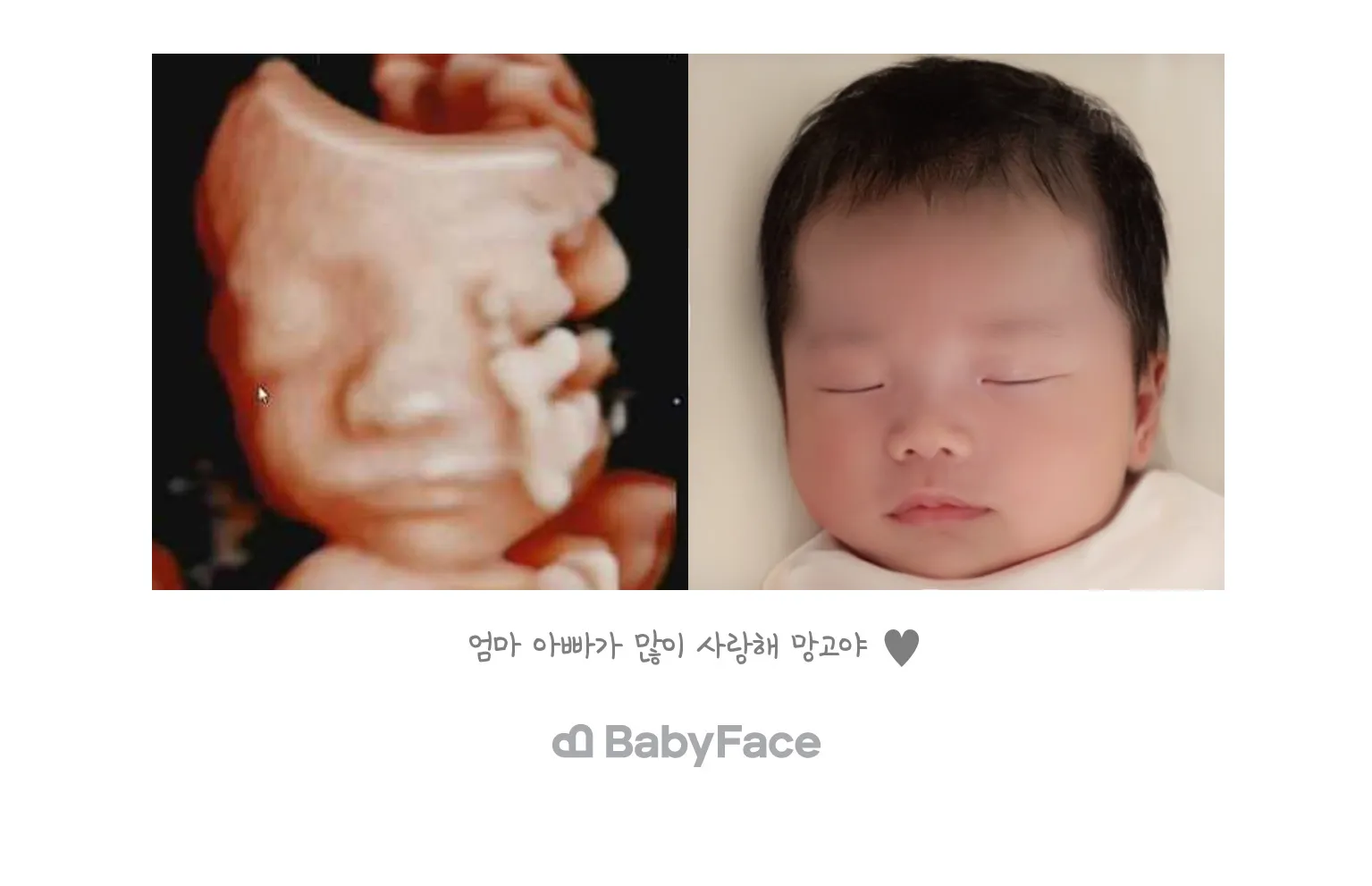 24주5일 베페 해봤습니다
