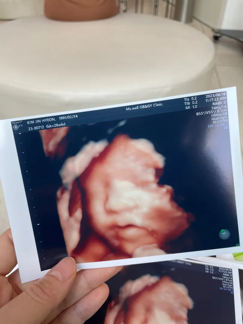 28주 6일차 2차 정밀초음파 보고왔어요 :) 