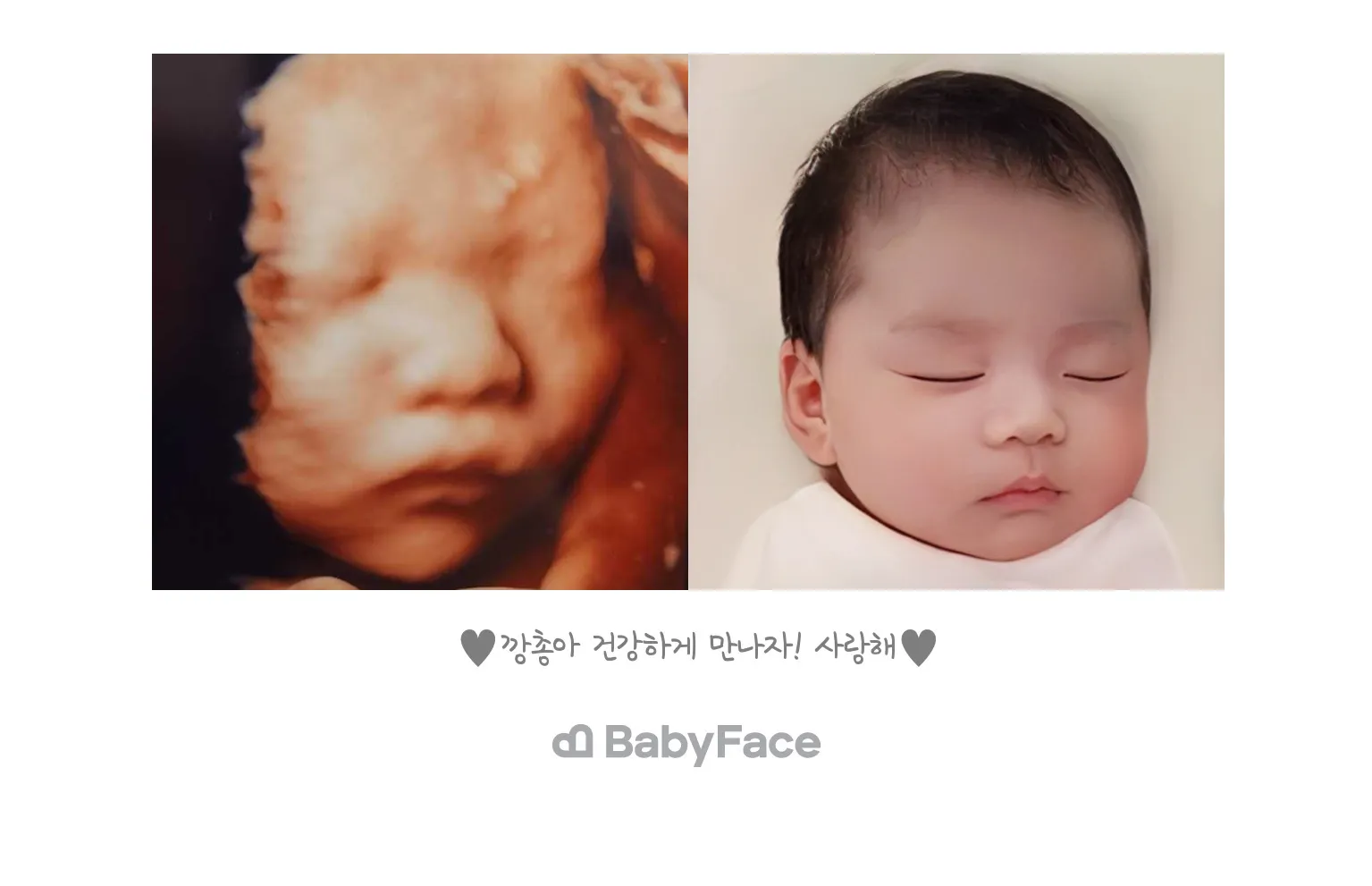 깡총이 베이비페이스!😍