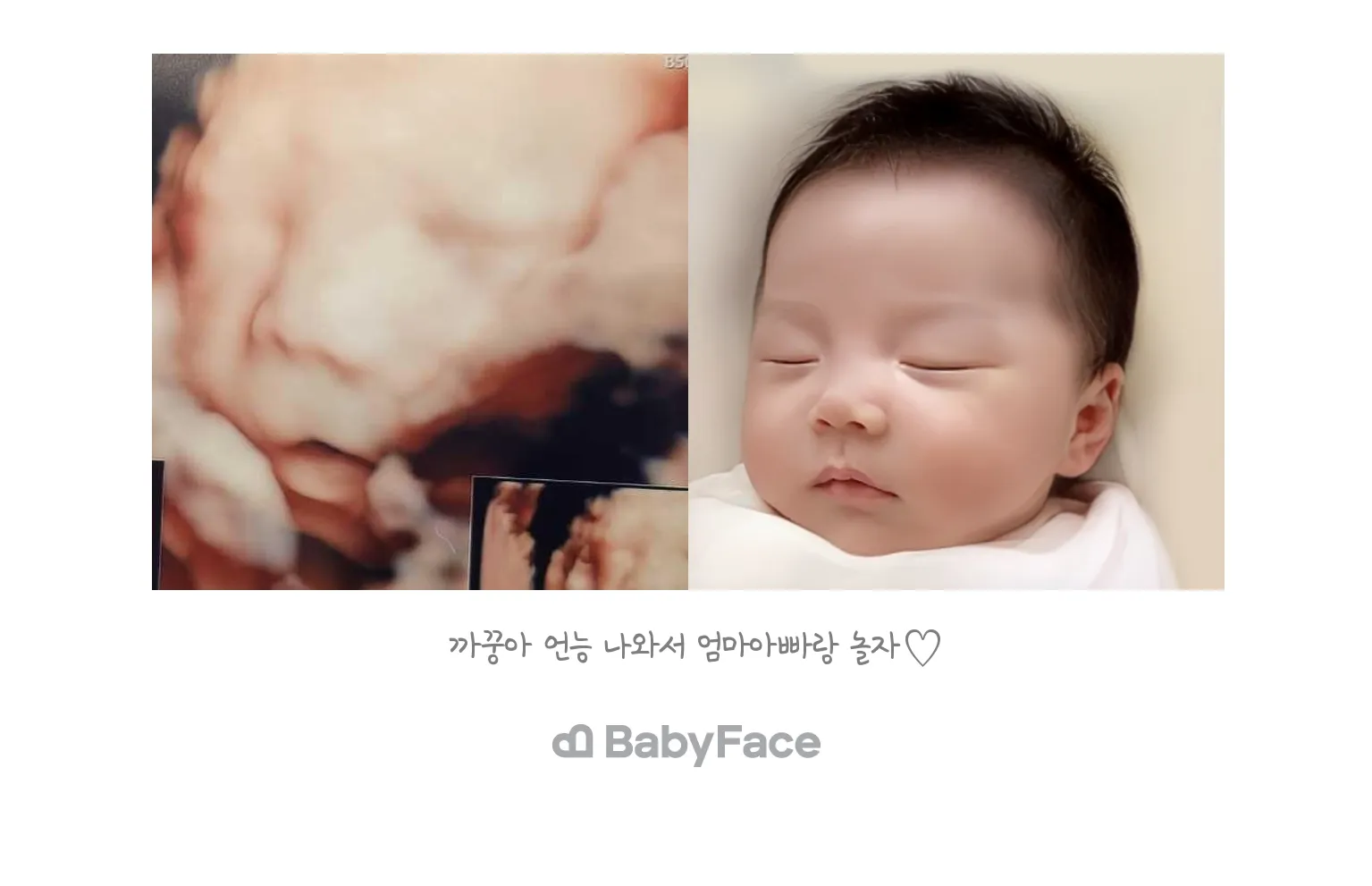 베이비페이스했어요🥺🤍