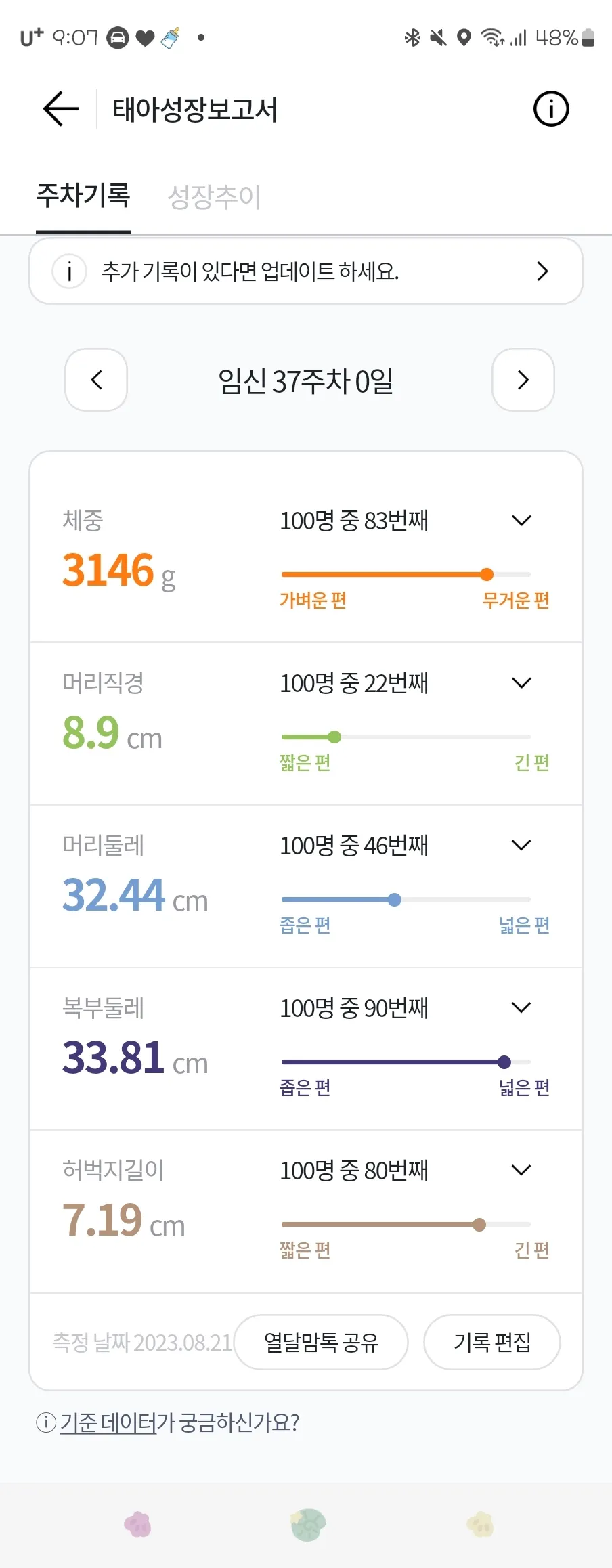 과장님이 아기 복부둘레가 한주 크다고 제왕하자고 하시네요