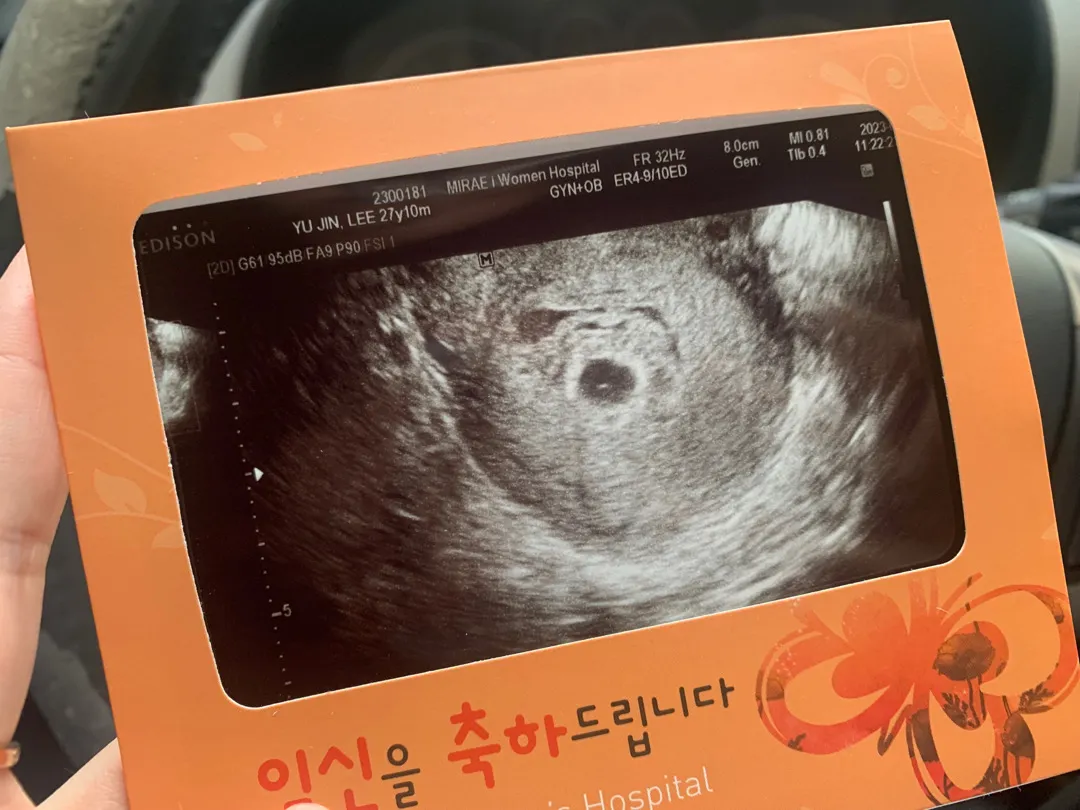 아기집한번봐주세요ㅠㅠ