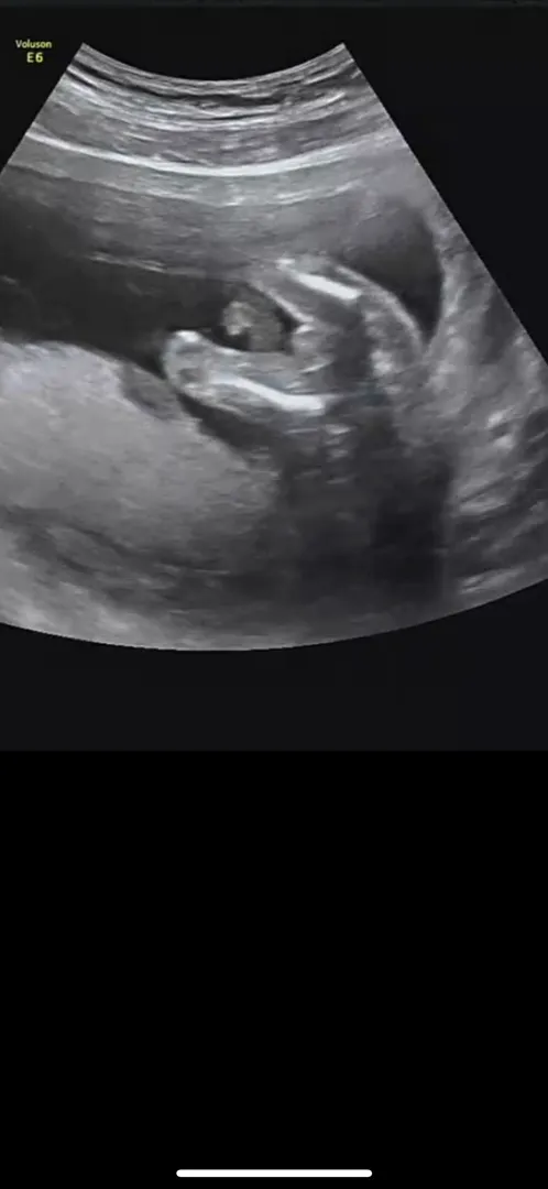 성별좀 봐주세용