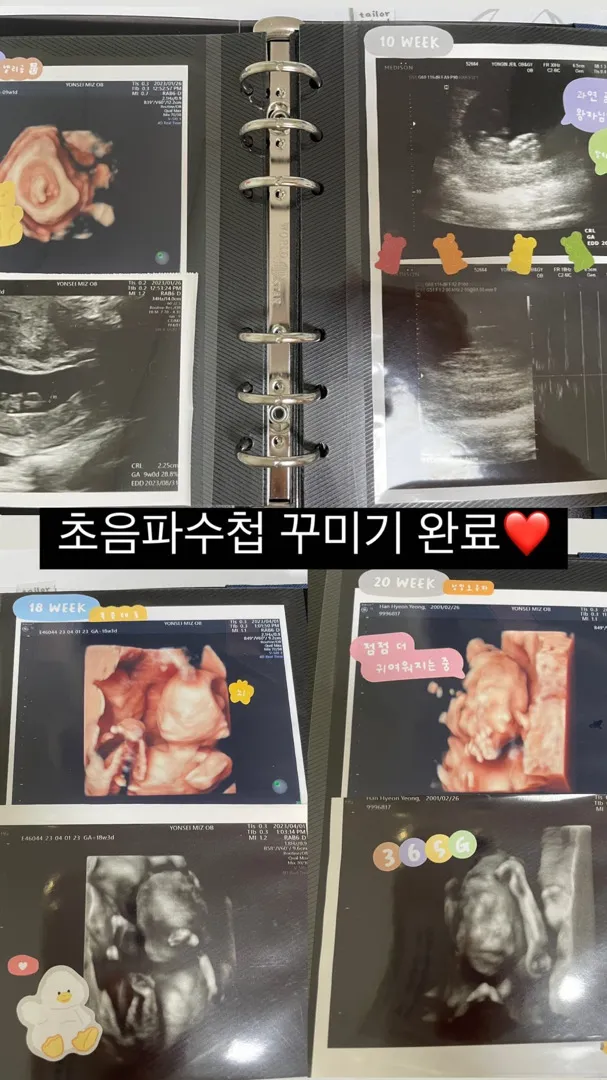 촘파앨범
