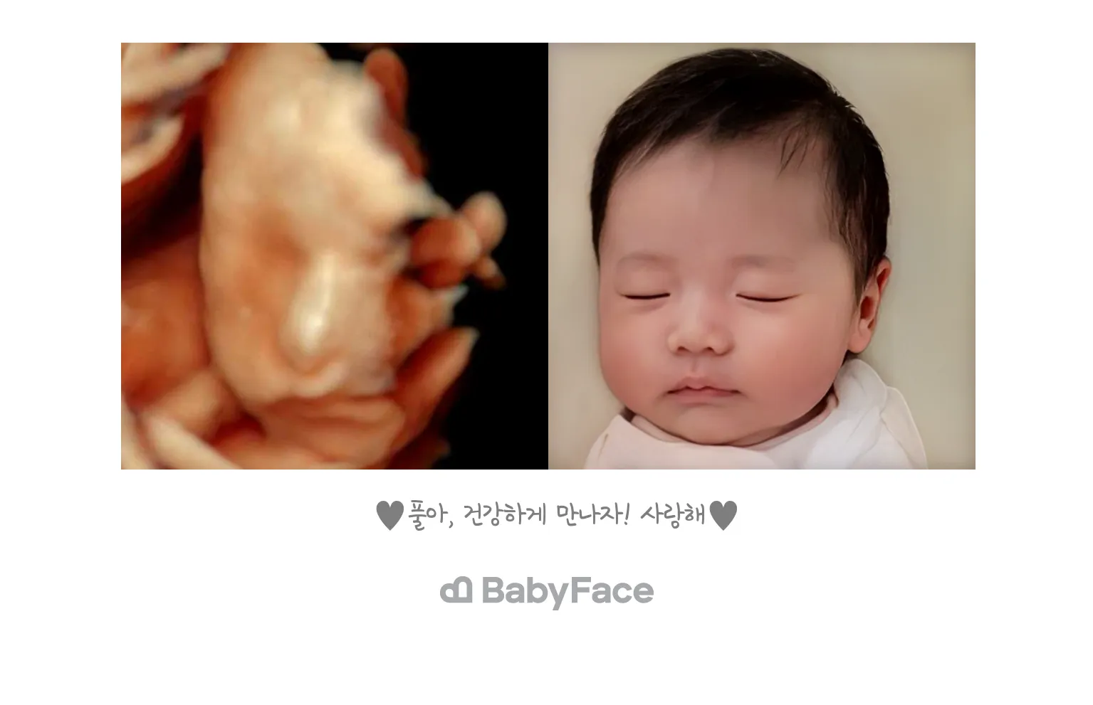 베이비페이스 후기(일반분석)