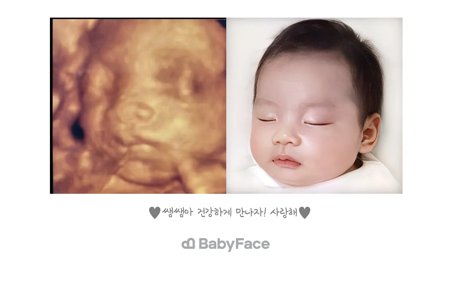 베이비페이스 결과가 나왔어요 ^^
