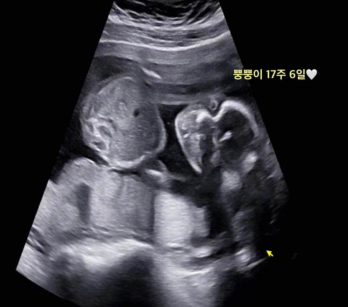 눈알 처음봤네용 띠용..👽