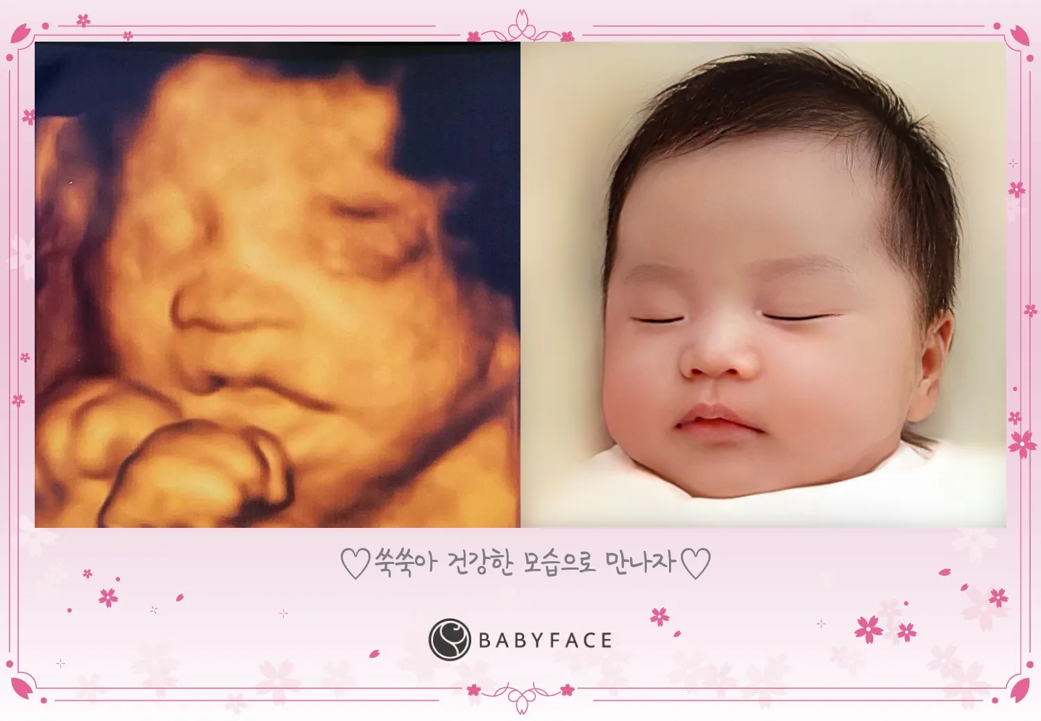 베이비페이스 후기❤쿠폰코드⭕️
