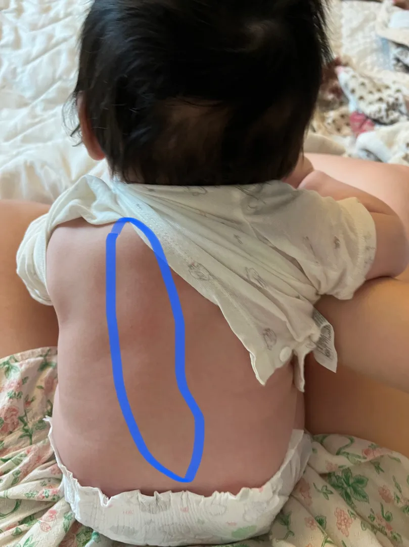 아기 등뼈가 왼쪽에 쏠려있어요ㅠㅠㅠ봐주세오