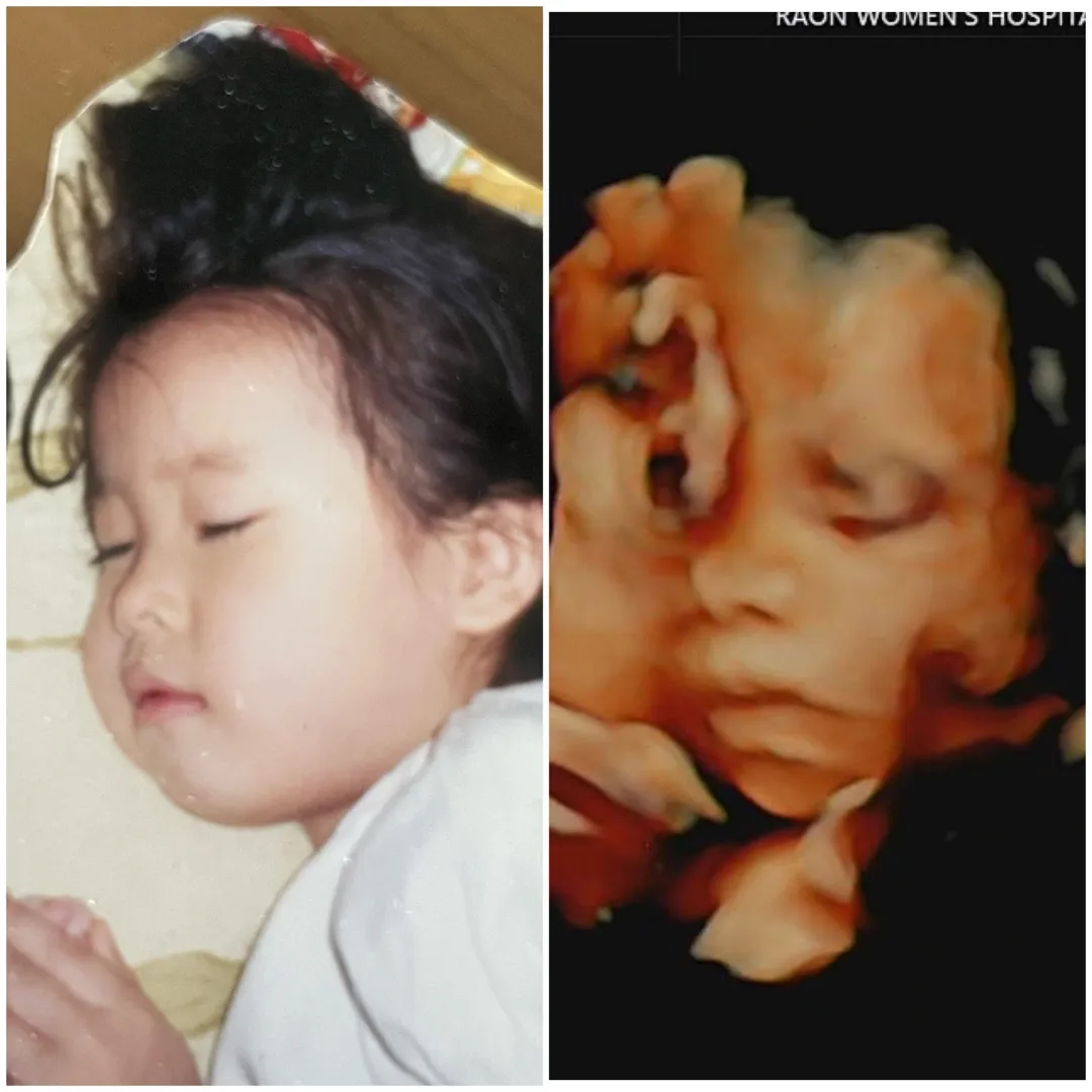 제 어릴때랑 판박이인 우리 아가👶🏻❤️