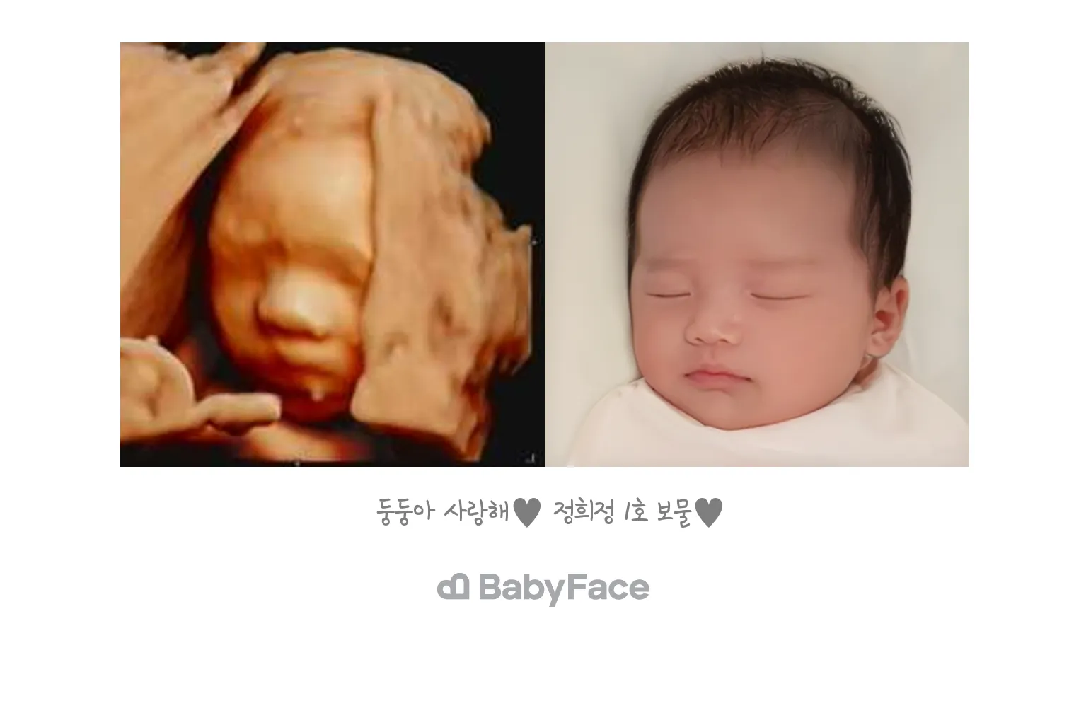 우리 둥둥이도 베이비페이스 했어요!!!