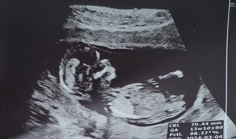 성별 각도법 문의 드립니다.ㅎ